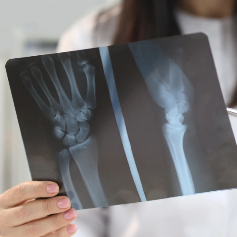 TRAUMOTOLOGÍA CLÍNICA FISIOTERAPIA ALICANTE